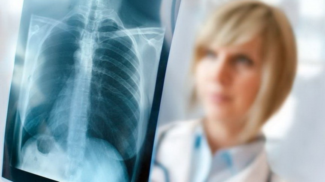 � ������� ���� ������������ �������� 155 ������� ����������