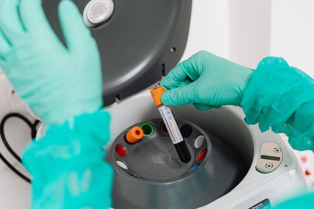 Эпидемическая ситуация: уровень заболеваемости ОРВИ уменьшился