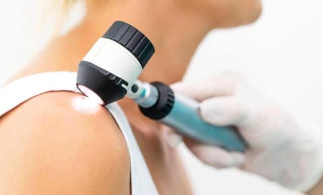 АТОшникам и членам их семей предлагают обследоваться на меланому