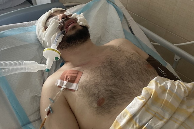 «Убегал и упал, ударившись головой»: ответ ТЦК по днепрянину, находящемуся в коме после встречи с группой оповещения