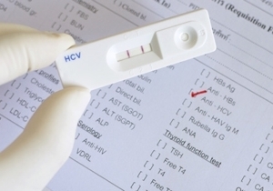 ��������������� ��������� �������������� �� �������