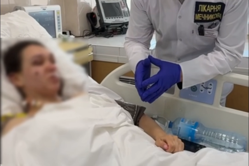 У Дніпрі рятують медкиню, тіло якої пошматовали уламки «Молнії»