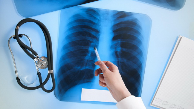 � ������ ���� � ��������� ������� 72 ������� ������������