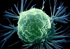 ��������� - ���! �������� �������!