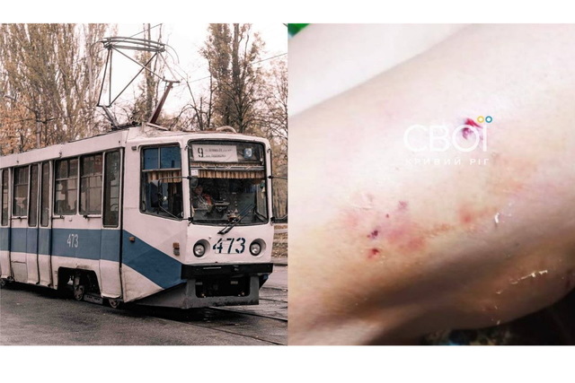 В Кривом Роге пассажир натравил собаку на водительницу трамвая: женщина в больнице