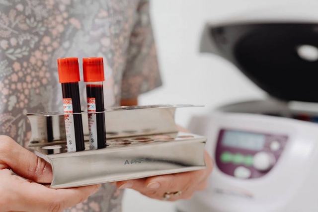 Епідеміологічна ситуація на Дніпропетровщині: Ситуація з COVID-19 продовжує покращуватися